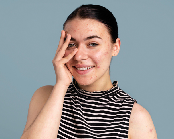Before editing — Portrait & Beauty Retouching (High-End Retouching)